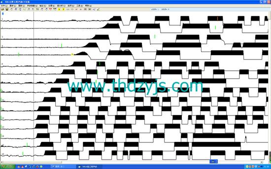 多功能声波检测仪|DB-16E